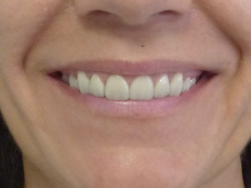 antes-tratamiento-odontologico